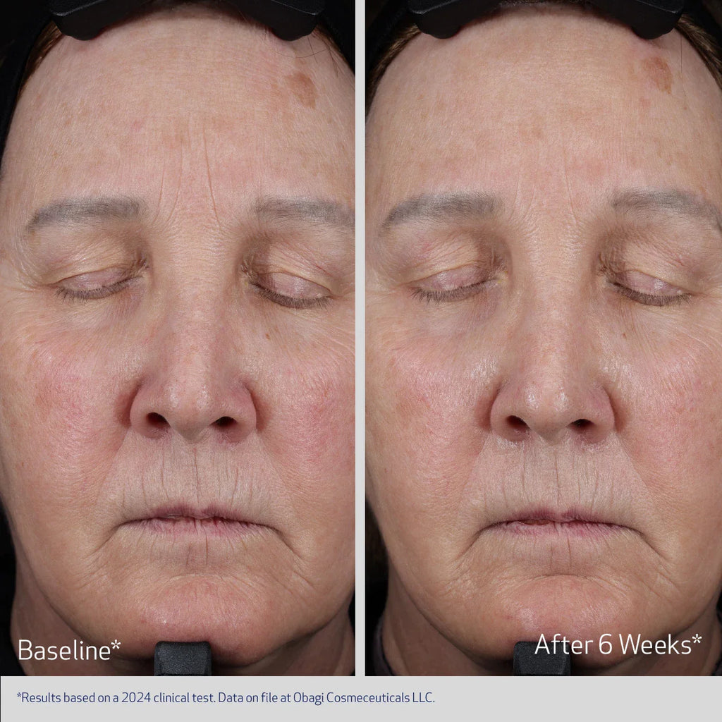 Obagi ELASTIDERM® Lift Up & Sculpt Facial Moisturizer