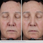 Obagi ELASTIDERM® Lift Up & Sculpt Facial Moisturizer