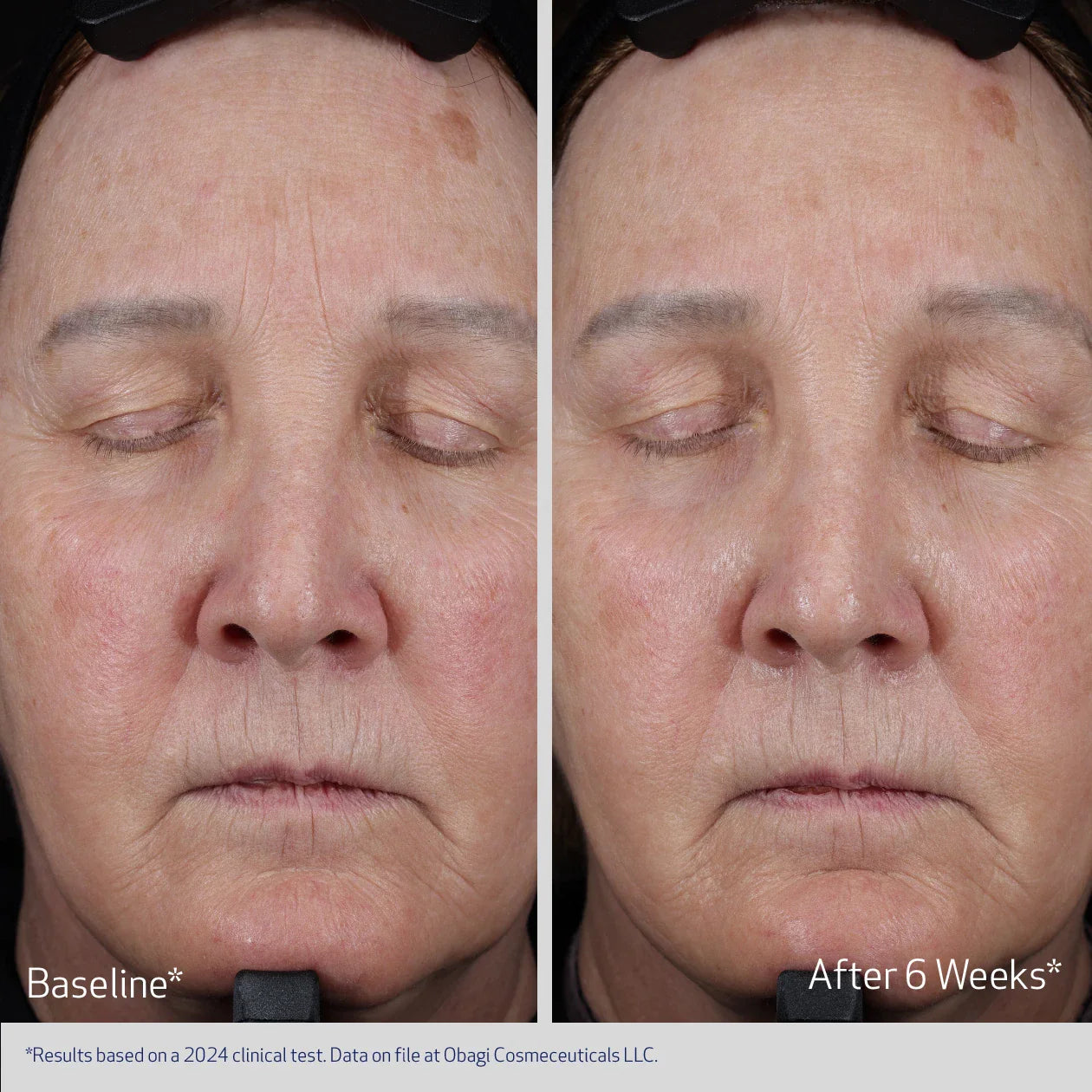 Obagi ELASTIDERM® Lift Up & Sculpt Facial Moisturizer