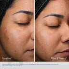 Obagi Retinol + PHA Refining Night Cream