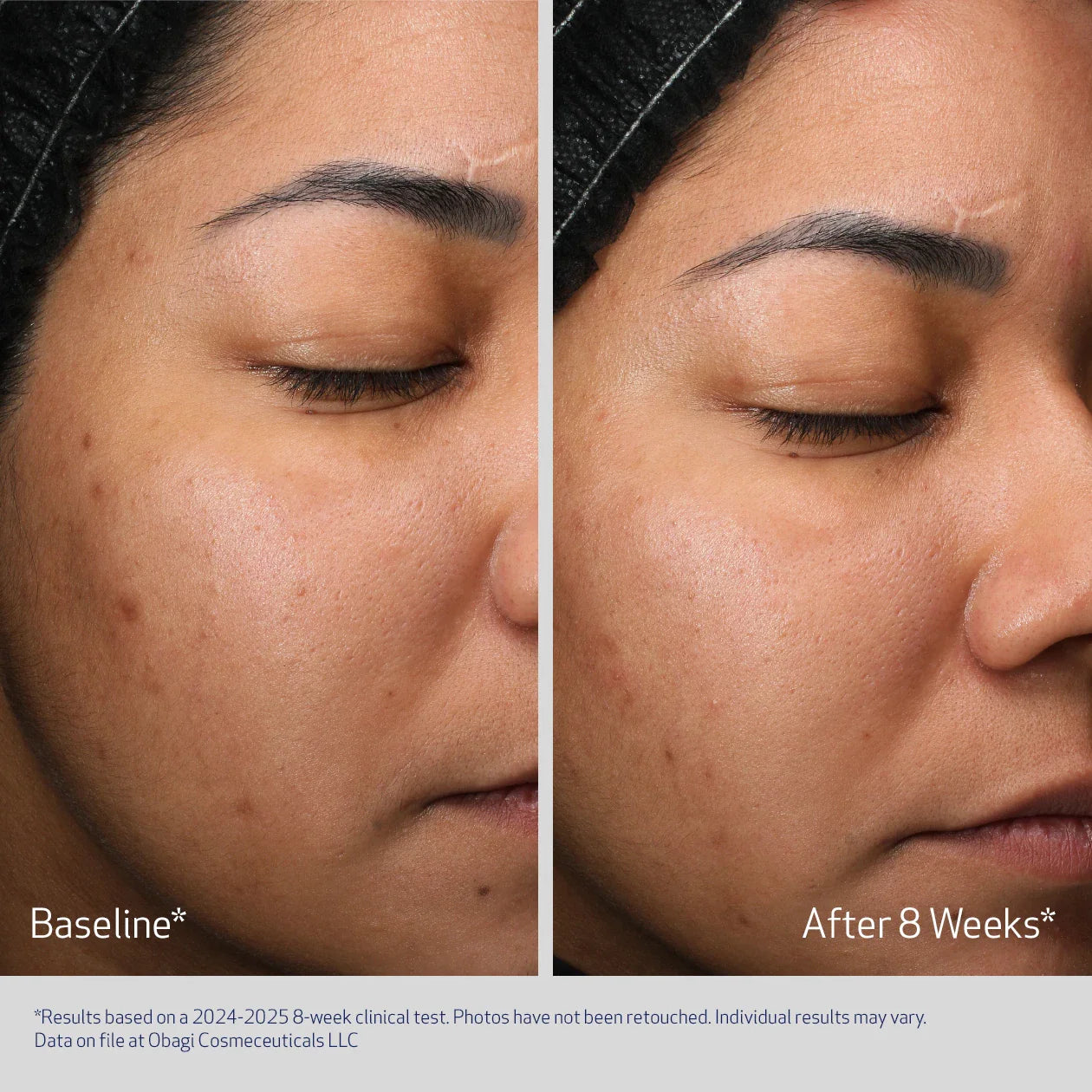 Obagi Retinol + PHA Refining Night Cream