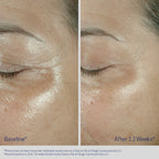 Obagi ELASTIDERM® Eye Cream