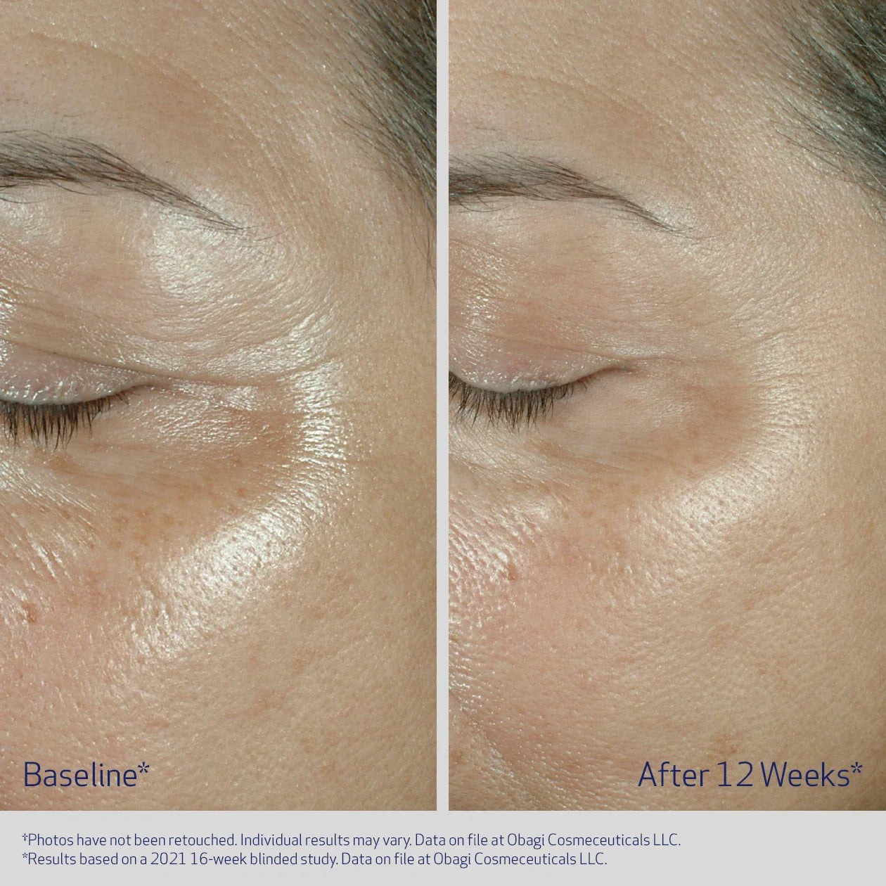Obagi ELASTIDERM® Eye Cream