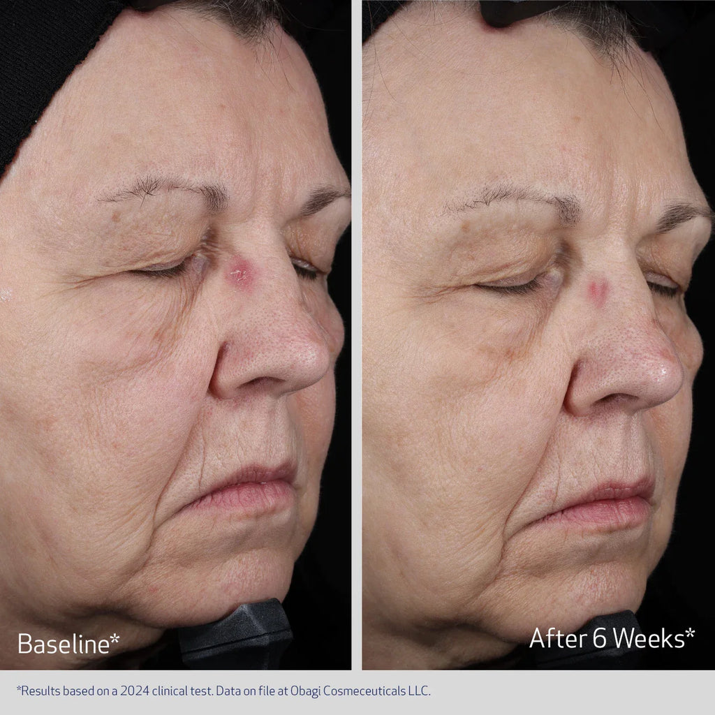 Obagi ELASTIDERM® Lift Up & Sculpt Facial Moisturizer