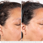 Obagi NU-CIL® BioStimTM Scalp Serum