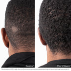 Obagi NU-CIL® BioStimTM Scalp Serum