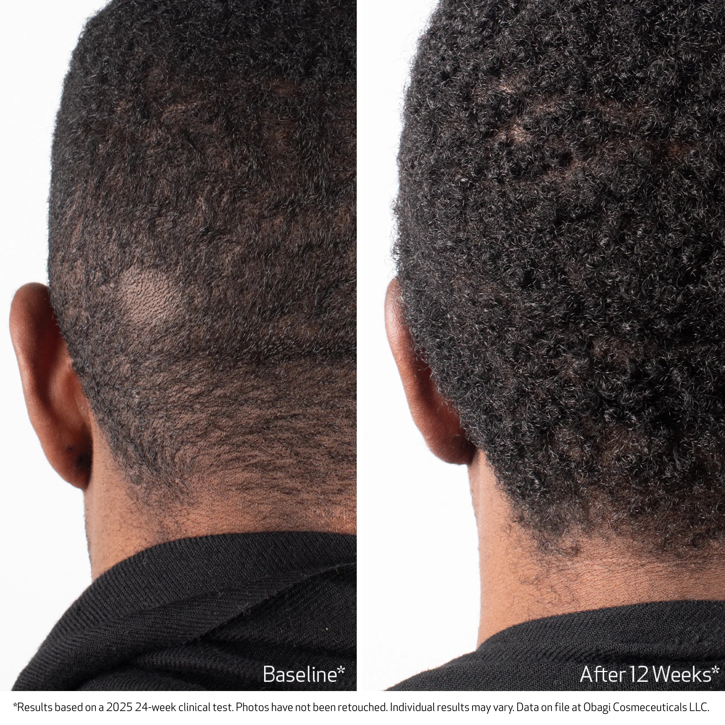 Obagi NU-CIL® BioStimTM Scalp Serum